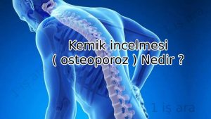 Kemik incelmesi ( osteoporoz ) Nedir ?