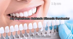 Diş Beyazlatma Hakkında Bilmeniz Gerekenler