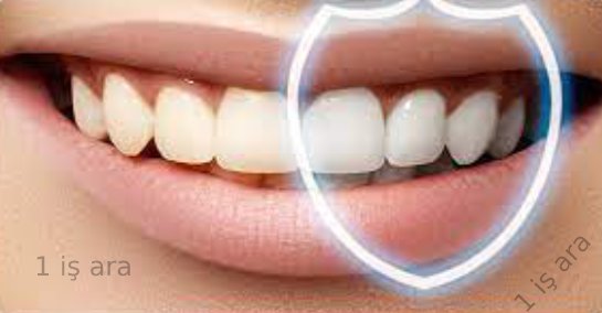 Diş Beyazlatma Hakkında Bilmeniz Gerekenler